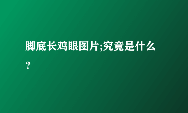 脚底长鸡眼图片;究竟是什么？