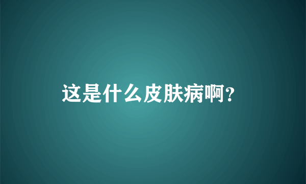 这是什么皮肤病啊？