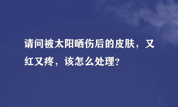 请问被太阳晒伤后的皮肤，又红又疼，该怎么处理？