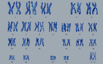 染色体49yyyxx什么意思？