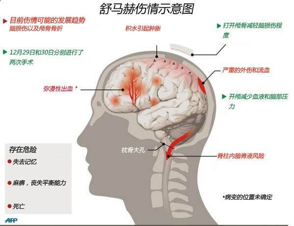 车王舒马赫现状如何？