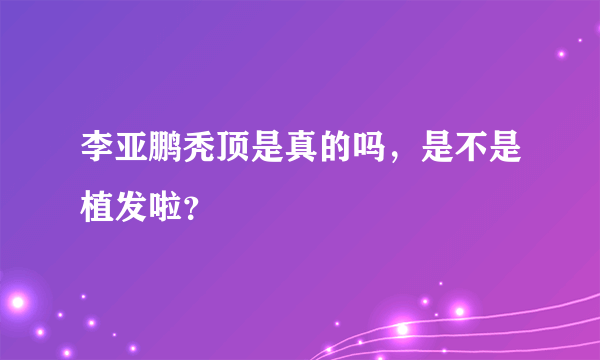 李亚鹏秃顶是真的吗，是不是植发啦？