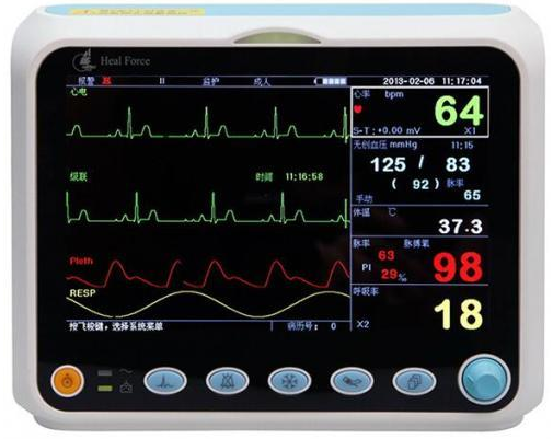 心电监护仪数据怎么看