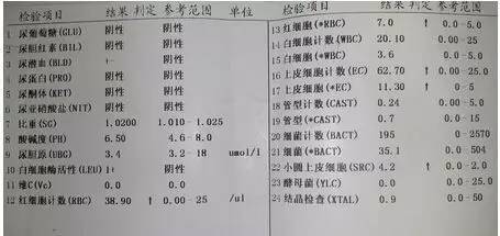 教你如何看尿常规化验单