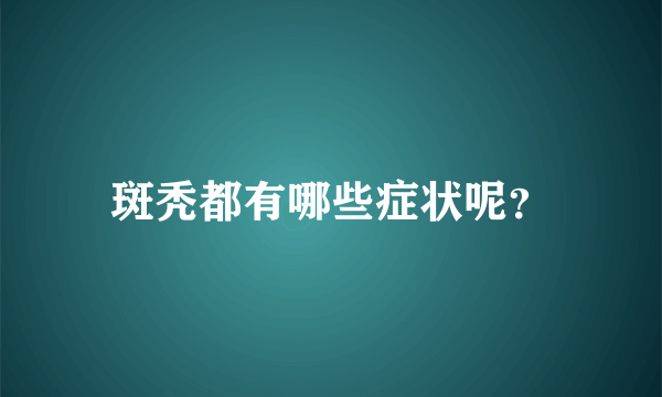 斑秃都有哪些症状呢？