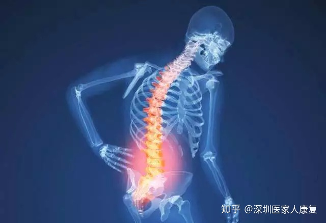 腰酸背痛怎么办？