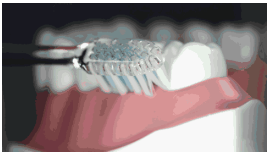 bass刷牙法是什么？