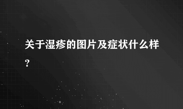 关于湿疹的图片及症状什么样？