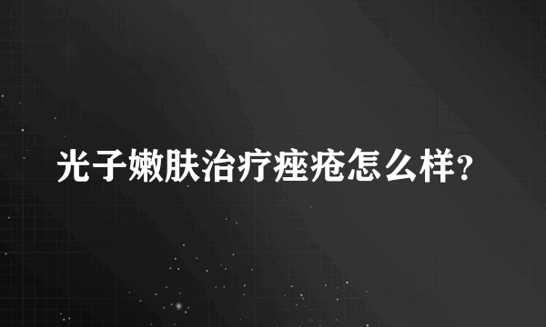 光子嫩肤治疗痤疮怎么样？