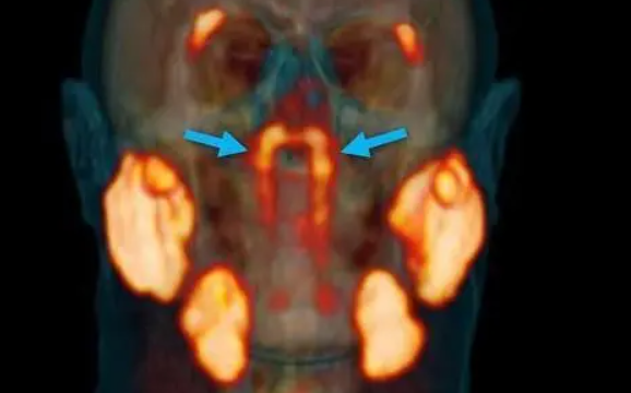 科学家意外发现人体新器官，究竟是什么器官？