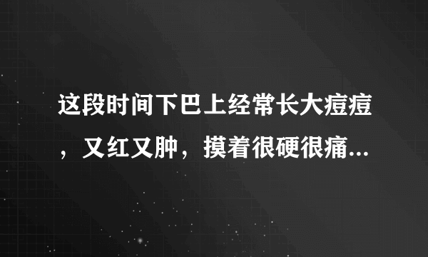 这段时间下巴上经常长大痘痘，又红又肿，摸着很硬很痛，这是怎么回事？