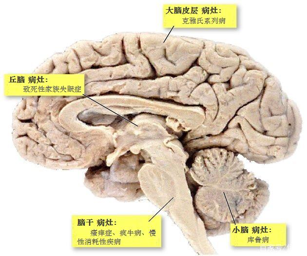 朊病毒是什么病毒？它为何被称为“生物界毒王”？