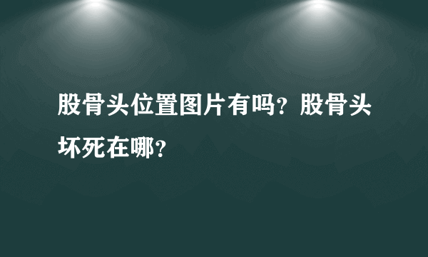 股骨头位置图片有吗？股骨头坏死在哪？